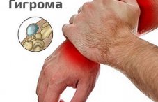 Клиническая картина