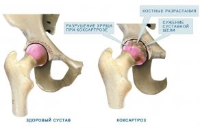 Боль в суставах голеностопа причины и лечение