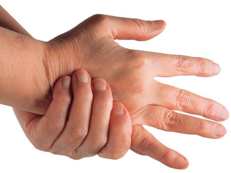 Артрита пальцев рук: лечение в домашних условиях народными средствами