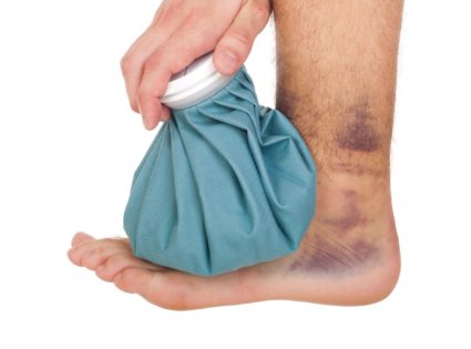 Повреждение связочного аппарата голеностопного сустава в футболеПовреждение связочного аппарата голеностопного сустава в футболе