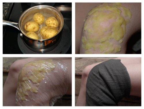 Ростки картофеля лечение суставов