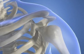 Рентген плечевого сустава: фото рентгеновского снимка плеча