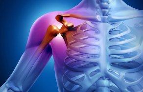 Киста плеча: лечение, симптомы и фото плечевого сустава