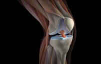 Боль под коленной чашечкой: почему болит, что делать при болях в коленке