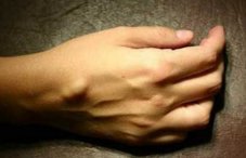 Киста на запястье руки: фото, причины и лечение лучезапястного сустава