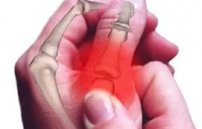Болит сустав на большом пальце руки: причины боли на правой и левой руке