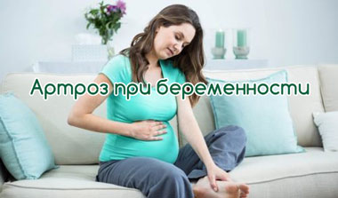 Беременность при артрозе коленного сустава