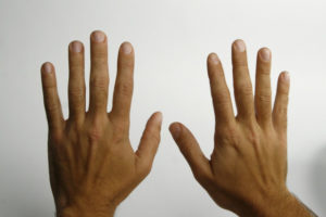 Скручивание пальцев на руках. Болезнь скрюченных пальцев, или как бороться с воспалением суставов кисти