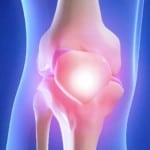 Изображение - Гонит коленного сустава симптомы и лечение 0-422-150x150