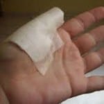 Изображение - Как лечить ушиб сустава пальца руки 7-11-150x150