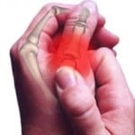 Изображение - Как лечить ушиб сустава пальца руки 7-9-150x150