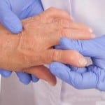 серопозитивный артрит пальцев 