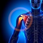 Периартроз плечевого сустава лечение симптомы причины методы