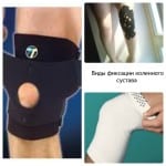 Операция на связки коленного сустава
