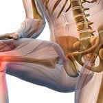 Лечение артроза коленного сустава 2 степени желатином thumbnail