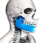 Артроз челюсти симптомы лечение