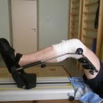 Изображение - Реконструкция поведения после замены сустава коленного 1-158-150x150