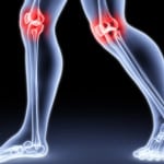 Изображение - Заболевания суставов ног и их лечение 1-48-150x150