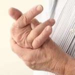 Остеоартроз пальцев