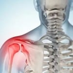 Травмы плечевого сустава
