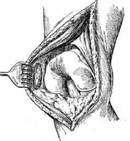 Причины развития, проявления и терапия артропатии голеностопного сустава
