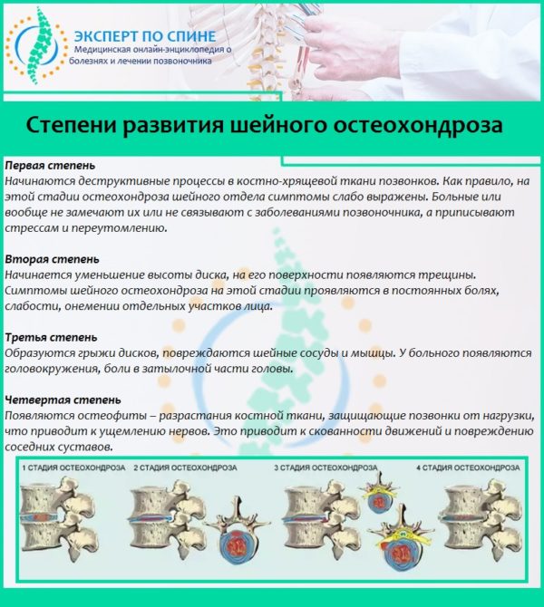 chto sheynom pri osteohondroze obsledovaniya plan udachi План обследования при шейном остеохондрозе фото