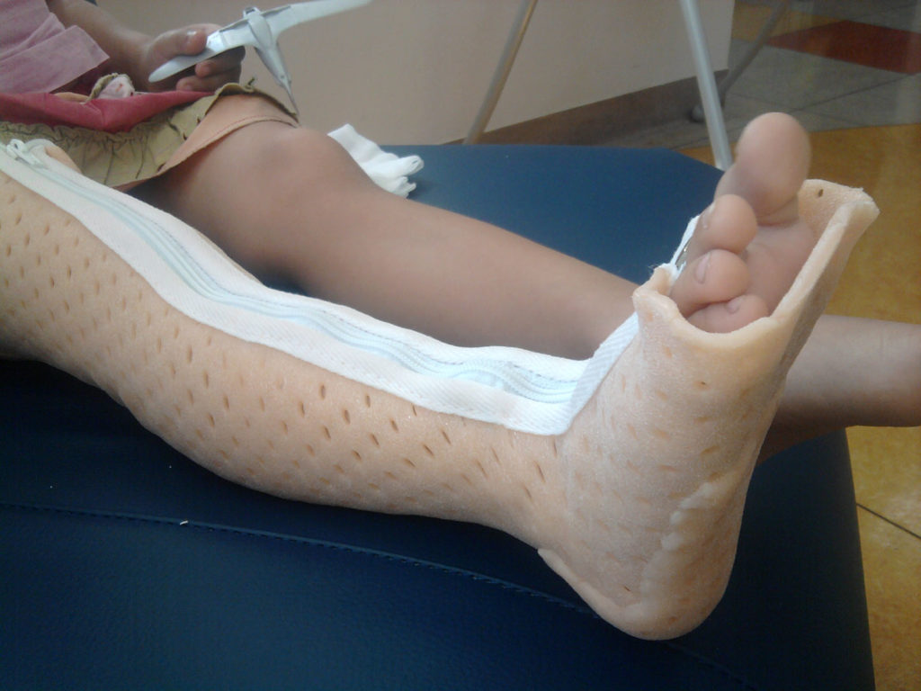 Лангетка на ногу для голеностопного сустава