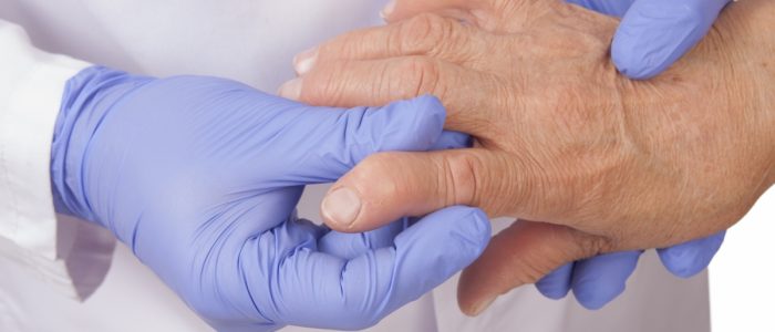 Почему возникает артрит после ангины причины осложнений, тактика лечения и профилактики