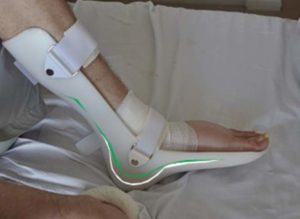 Лангетка на ногу для голеностопного сустава