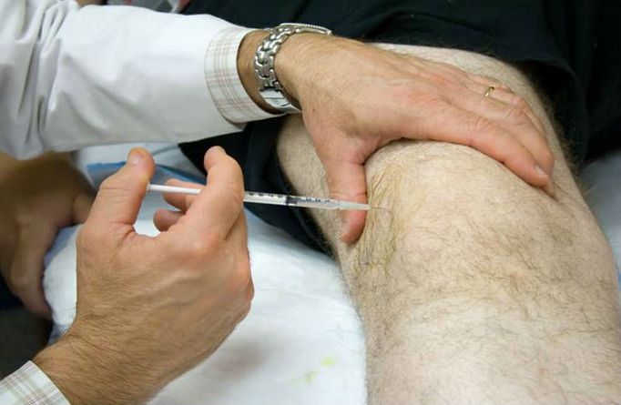 Обезболивающие при артрозе коленного сустава