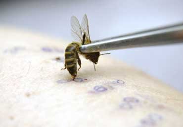 Обзор мазей с пчелиным ядом