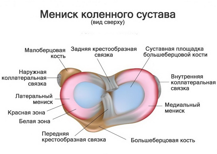 Повреждение мениска коленного сустава код по МКБ-10