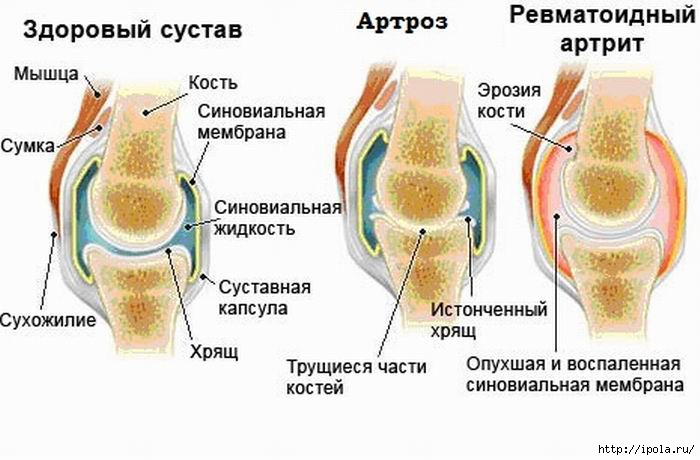 Эффективные мази для лечения суставов колена