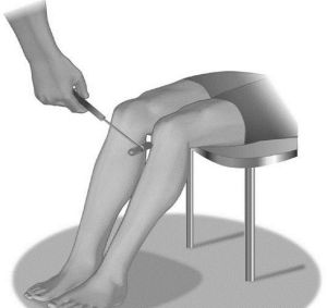Рефлекс коленного сустава описание