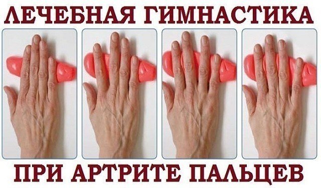 Деформация суставов лечение искривления пальцев рук