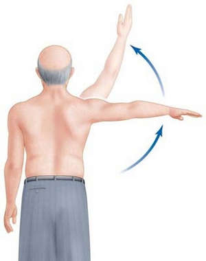 Капсулит плечевого сустава симптомы и лечение заболевания замороженное плечо