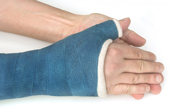Зачем выполнять ЛФК при переломе костей руки в области лучезапястного сустава