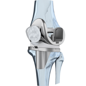 Эндопротез коленного сустава фирмы Aesculap Эскулап особенности протезирования
